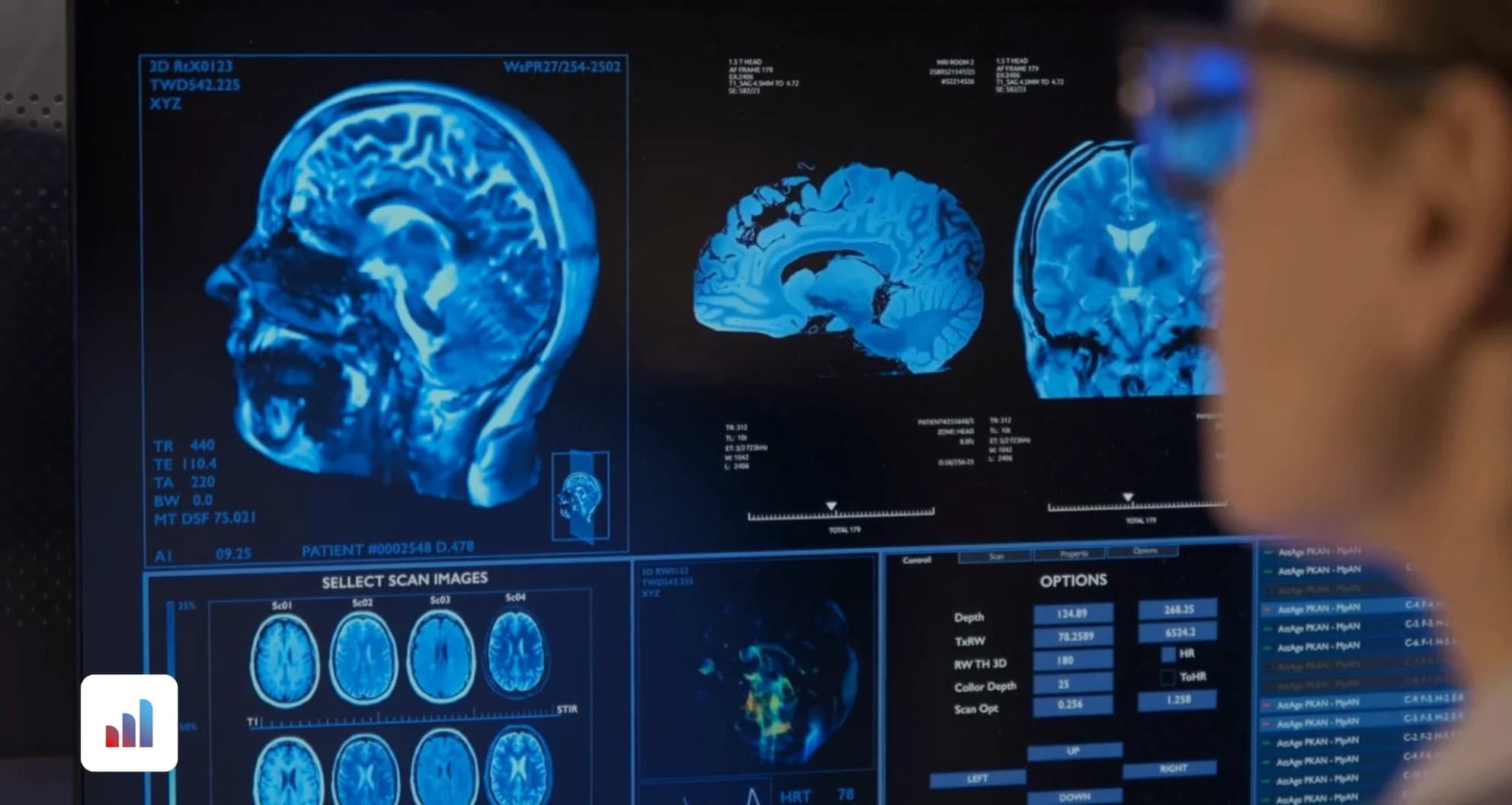 Glioma Cancer MRI Medical Imaging Dataset