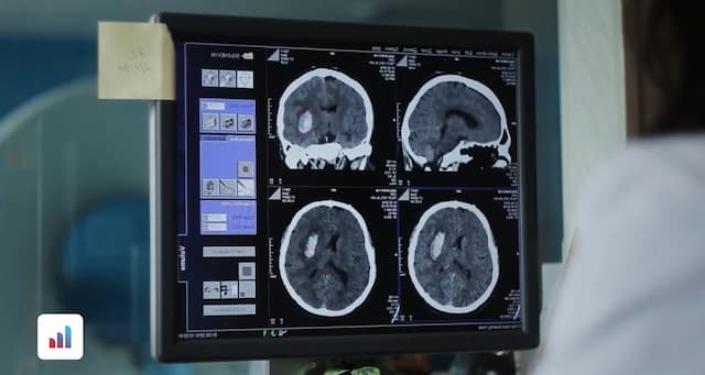 Notumor Cancer MRI Medical Imaging Dataset for Brain